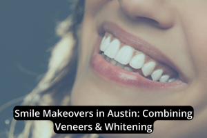 Close-up of a woman's bright, white smile with text overlay: "Smile Makeovers in Austin: Transform your look with Veneers & Whitening.