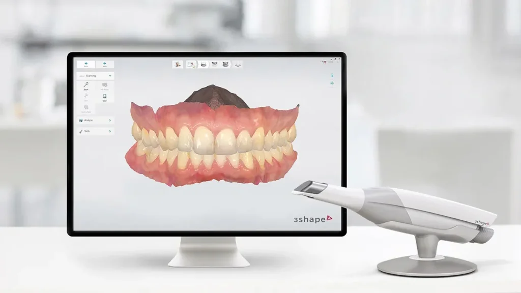 A computer monitor displays a 3D digital model of upper and lower teeth, useful for planning porcelain crowns, with a dental scanner device placed next to it on a white desk.